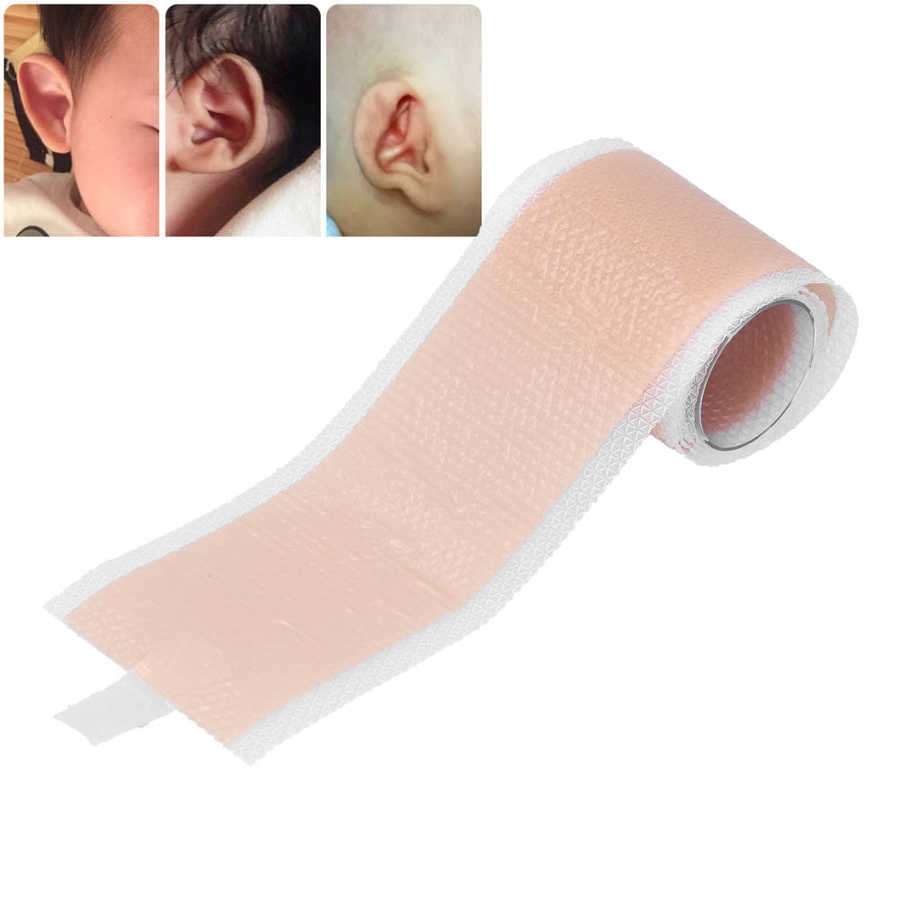 4 x 50cm Silicone Newborn Baby Ear Aesthetic Correctors Kids Infant Protruding Ear Patch Stickers